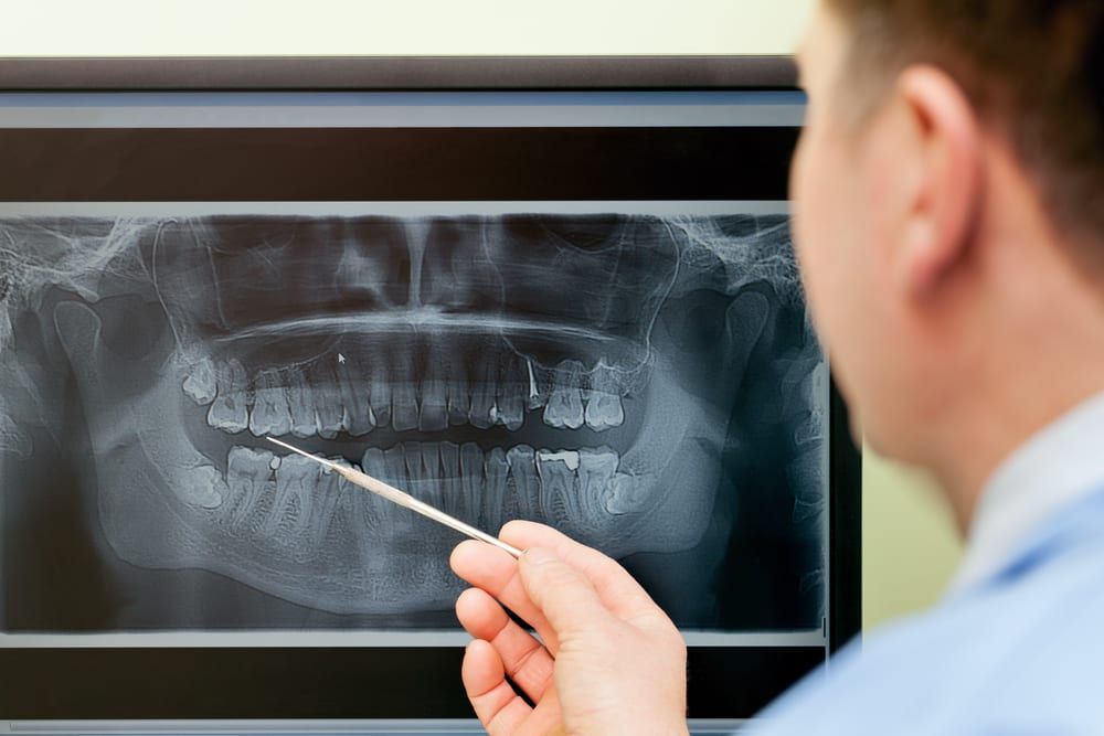 Digital XRays » North Branford Dentist North Branford Dental Group