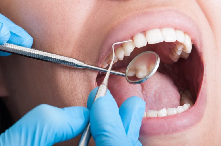 Close up image of a Dentist using tools to clean the teeth of a patient